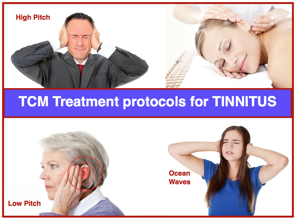 TCM Treatment for Tinnitus AcuPro Academy