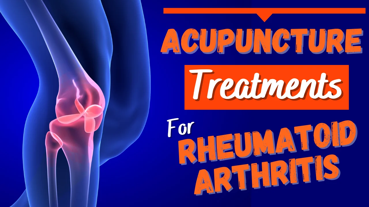 Acupuncture for Rheumatoid arthritis