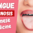 Tongue Diagnosis in Chinese Medicine