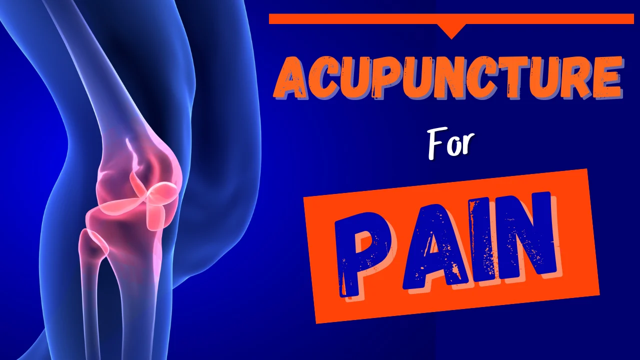 Acupuncture points for Pain
