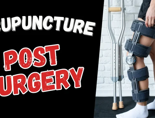 Post Surgery Acupuncture For Faster Recovery