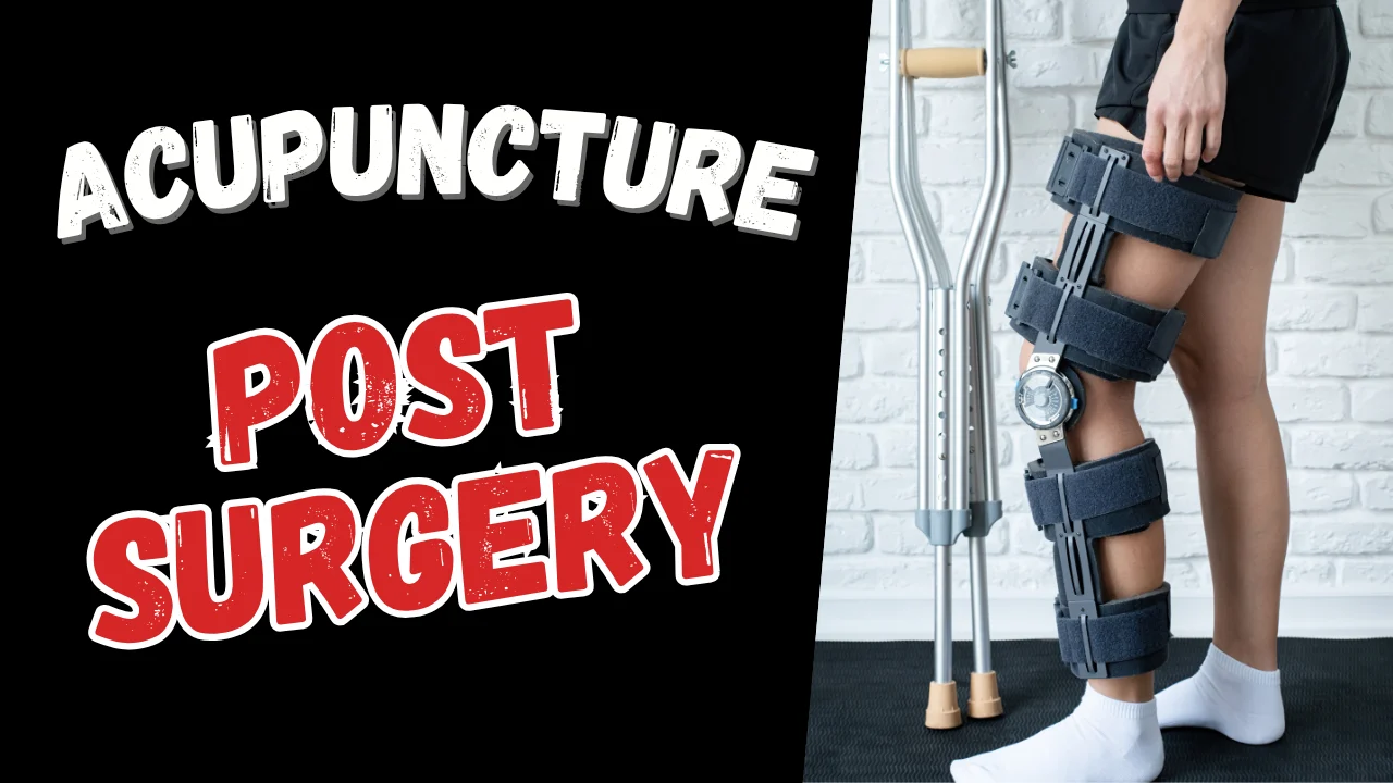 pre and post surgery acupuncture
